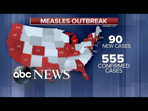 Man unaware he had measles unknowingly infected 38 people in 2 weeks episode artwork