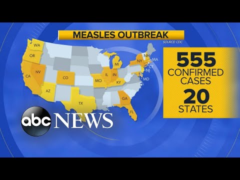 'Patient zero' identified in Michigan measles outbreak: Report l GMA episode artwork