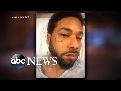 Chicago police chief speaks out on Jussie Smollett case episode artwork