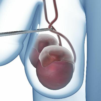 Aflevering 13 - Zaadzeefje Aflevering 13 - Zaadzeefje