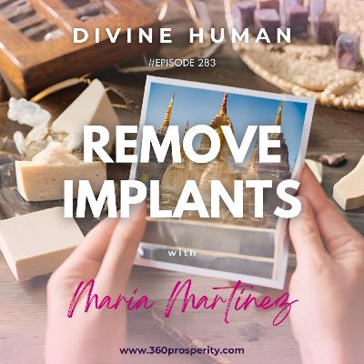 Episode 283 Remove Implants