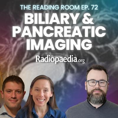 72. Biliary and pancreatic imaging update 72. Biliary and pancreatic imaging update