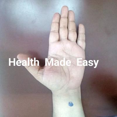 Why Not Try This Magical Treatment To Control Travelling Sickness Problem !