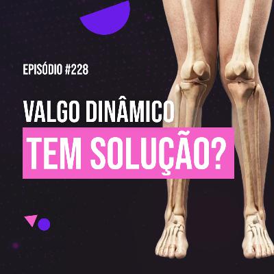 Ep. 228 - Tudo sobre Valgo Dinâmico: por que acontece e como corrigir de verdade Ep. 228 - Tudo sobre Valgo Dinâmico: por que acontece e como corrigir de verdade