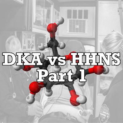 DKA vs HHNS Part 1 DKA vs HHNS Part 1