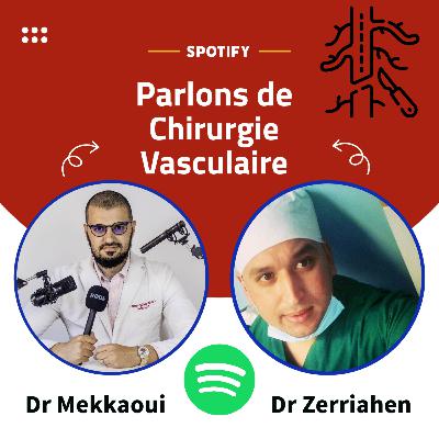 Parlons de Chirurgie vasculaire Dr Zerriahen