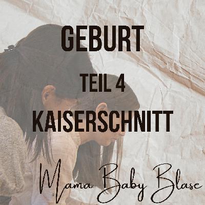 #40 Kaiserschnitt- bzw. Bauchgeburt