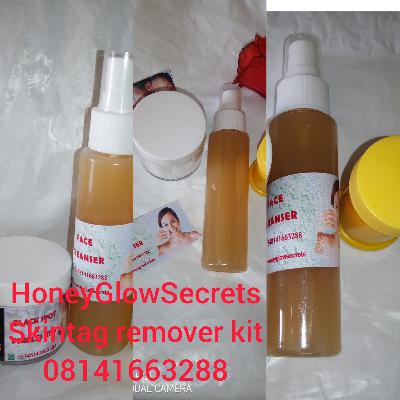 Skintags, warts and moles are not dangerous