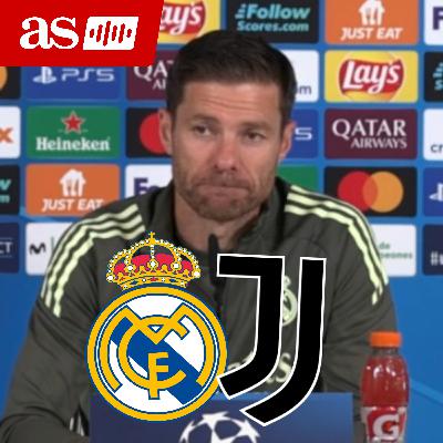 XABI ALONSO, RUEDA DE PRENSA COMPLETA HOY | Previa REAL MADRID vs. JUVENTUS FC de CHAMPIONS LEAGUE
