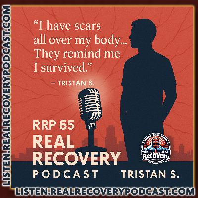 RRP Episode 65 – Tristan S.: Strength in the Scars—Seven Overdoses and the Road to Recovery