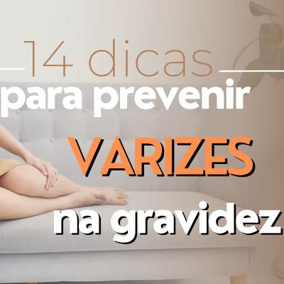 Grávida: VARIZES | 14 DICAS para PREVENIR e EVITAR na GRAVIDEZ - Ludmilla Hirata