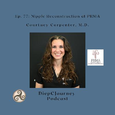 Episode 77: Nipple Reconstruction at PRMA