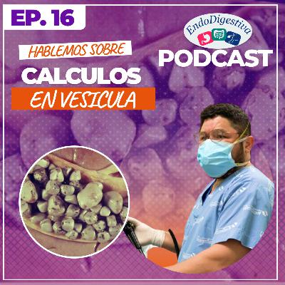 Cálculos biliares, síntomas, prevención y tratamiento
