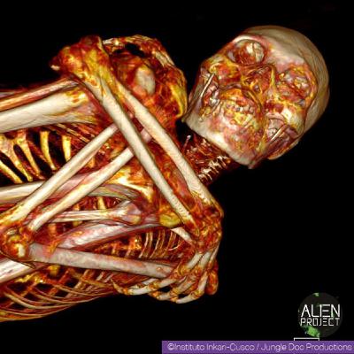 Nazca Mummies (The Results)
