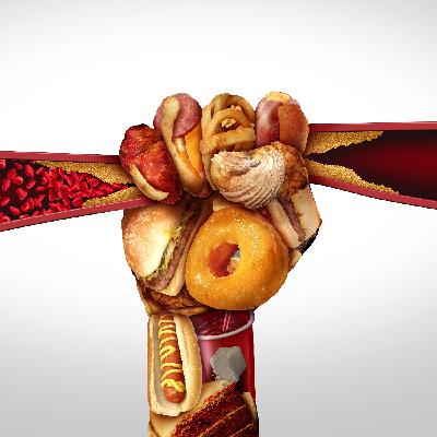 Estatinas, hiperrespuesta LDL y el inoportuno MRFIT Estatinas, hiperrespuesta LDL y el inoportuno MRFIT