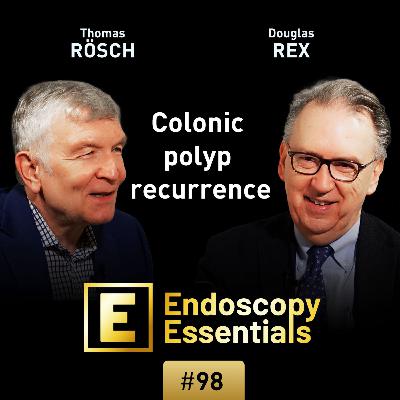 Colonic polyp recurrence Colonic polyp recurrence