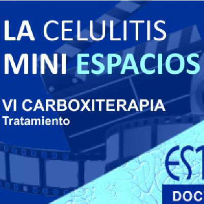 MINI ESPACIO "LA CELULITIS". (Carboxiterapia - Tratamiento) MINI ESPACIO "LA CELULITIS". (Carboxiterapia - Tratamiento)