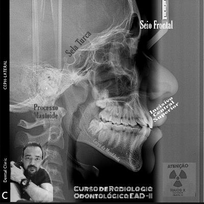Radiologia Odontológica Forense.