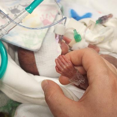 24 - Henry - The 22 Week Micro-Preemie 24 - Henry - The 22 Week Micro-Preemie