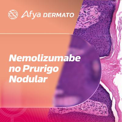 Nemolizumabe no prurigo nodular: qual relevância clínica dos dados de longa duração?