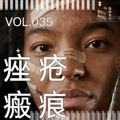 035. 10年抗痘血泪史,痘痘为什么这么难治? 035. 10年抗痘血泪史,痘痘为什么这么难治?