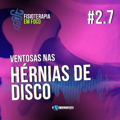 VENTOSAS nas HÉRNIAS DE DISCO - FUNCIONA?
