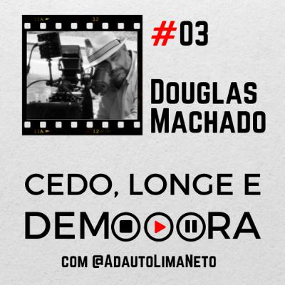 #03 - Douglas Machado