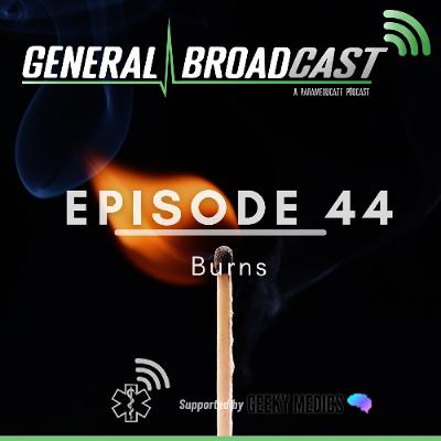 Burns
