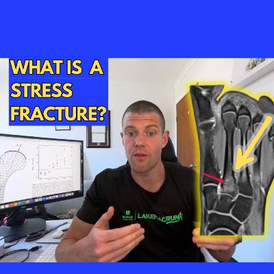 Stress Fractures in Runners | What They Are and Why They Matter #126