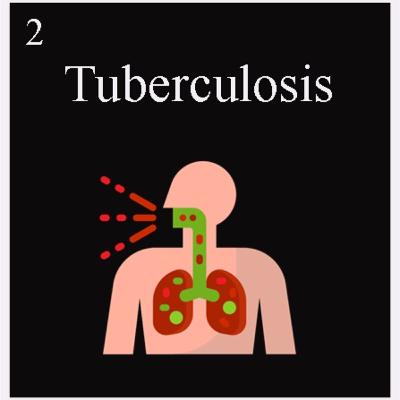 2. Tuberculosis