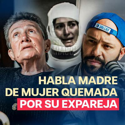 MUJER ES QUEMADA VIVA POR SU EXPAREJA (Relato de su madre)