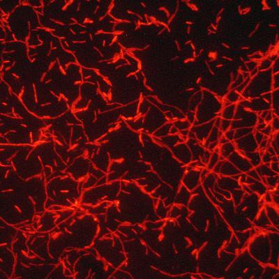 4. De senaste rönen om Legionella i Sverige och internationellt
