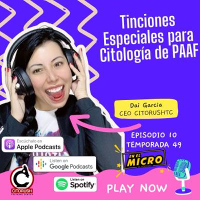 Tinciones especiales utilizadas en Citología de PAAF