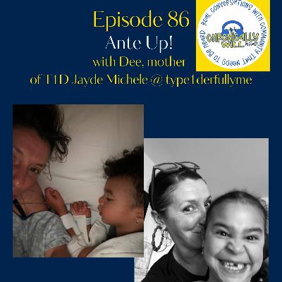 Episode 86: Ante Up!