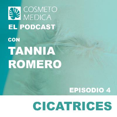 Cicatrices