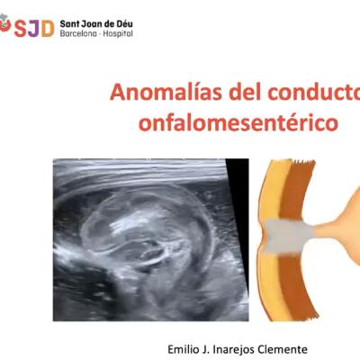 Anomalías del conducto onfalomesentérico en Pediatría