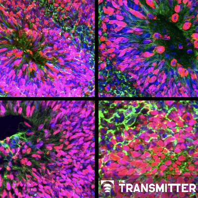 New organoid atlas unveils four neurodevelopmental signatures New organoid atlas unveils four neurodevelopmental signatures