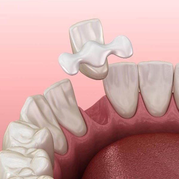 The OPTISMILE Podcast 100 - Maryland Bridges - The Conservative Replacement