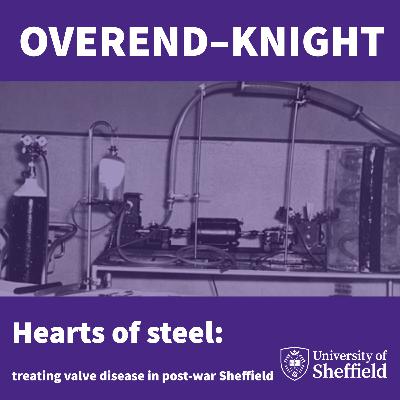 Hearts of steel: treating valve disease in post-war Sheffield