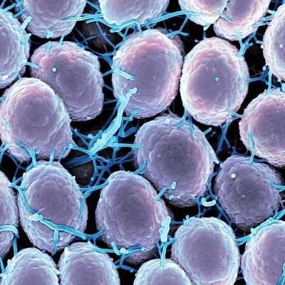 Over 20,000 cases of sexually transmitted diseases reported last year