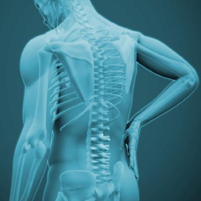 TRATAMIENTOS NO QUIRÚRGICOS DE COLUMNA - Clínica del Dr. Tarabini -  BUENVIVIR