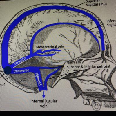 Basic anatomy of Cerebral blood flow FRCA
