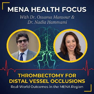 MENA Health Focus: Thrombectomy for Distal Vessel Occlusions - Real-World Data vs. Clinical Trials