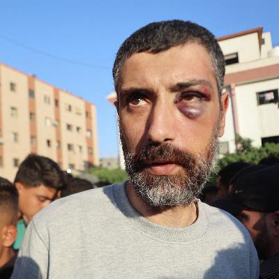 Freed Palestinian detainees allege torture in Israeli jail