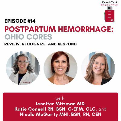 Postpartum Hemorrhage: Ohio CORES Series