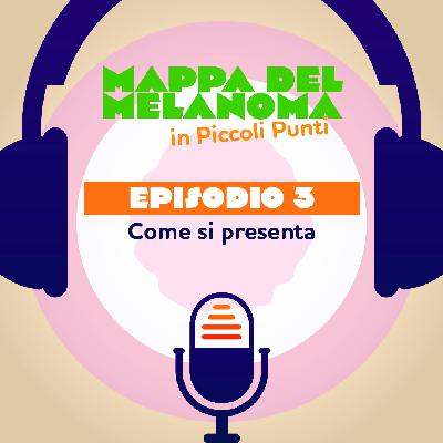 3. Melanoma: come si presenta 3. Melanoma: come si presenta