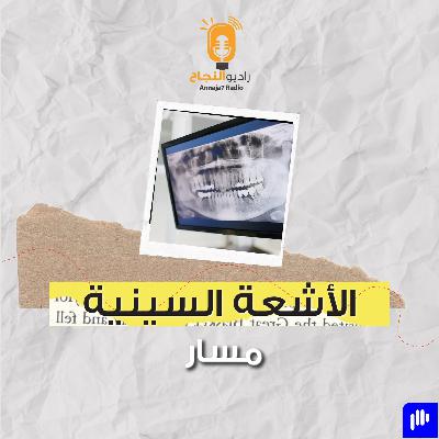 الأشعة السينية