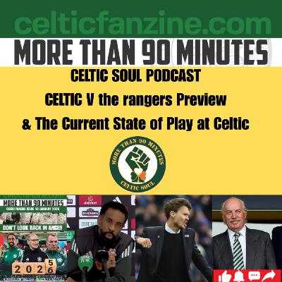 Celtic v the rangers Preview & the current State of Play at Celtic