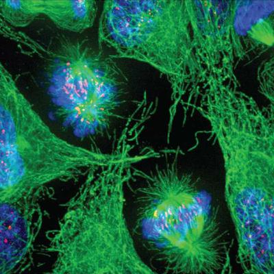 Cancer and the Immune System ( Immunology final part ) Cancer and the Immune System ( Immunology final part )