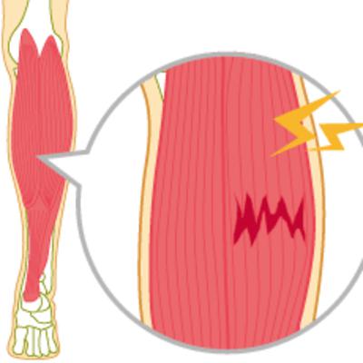 ［ついにやからした］オッさんの肉離れ